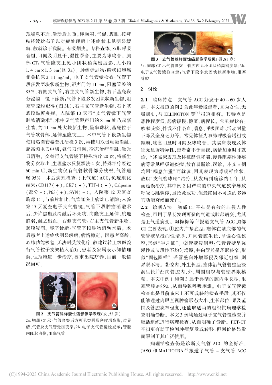 支气管腺样囊性癌误诊原因分析并文献复习_周兆珍.pdf_第3页