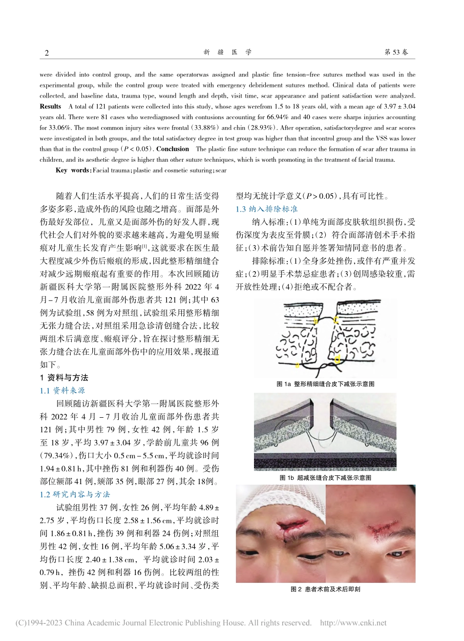 整形精细缝合对儿童面部外伤瘢痕形成的影响_迟宏羽.pdf_第2页