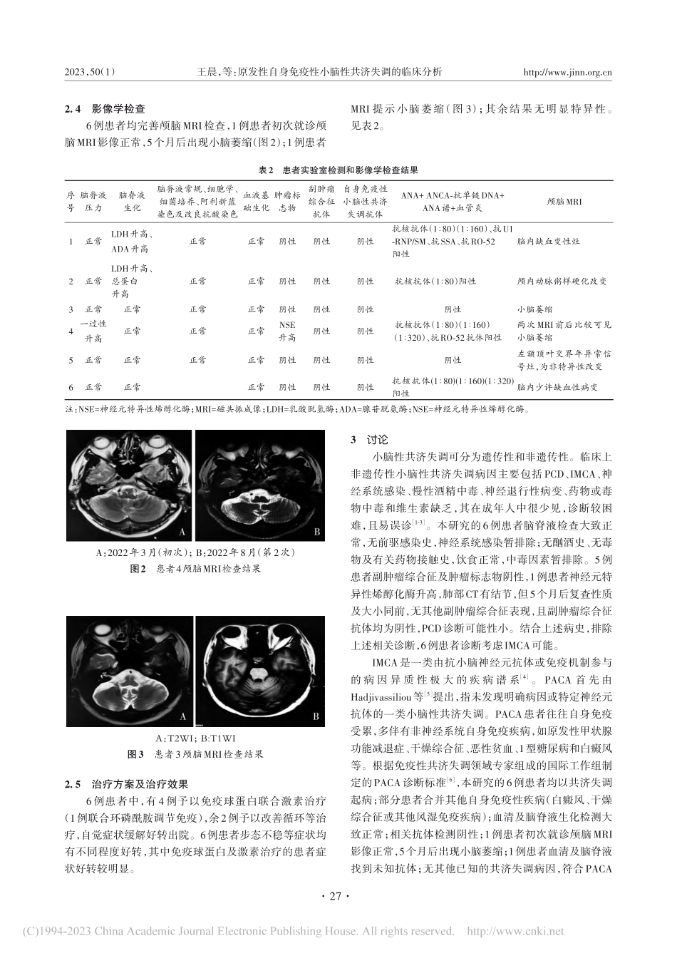 原发性自身免疫性小脑性共济失调的临床分析_王晨.pdf_第3页