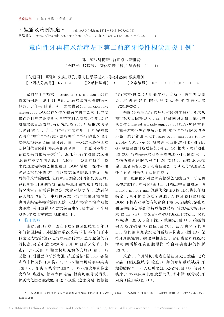 意向性牙再植术治疗左下第二前磨牙慢性根尖周炎1例_孙琼.pdf_第1页