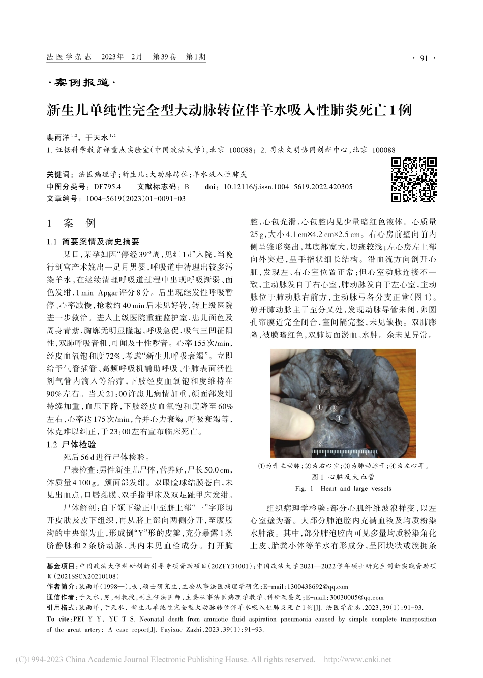 新生儿单纯性完全型大动脉转位伴羊水吸入性肺炎死亡1例_裴雨洋.pdf_第1页