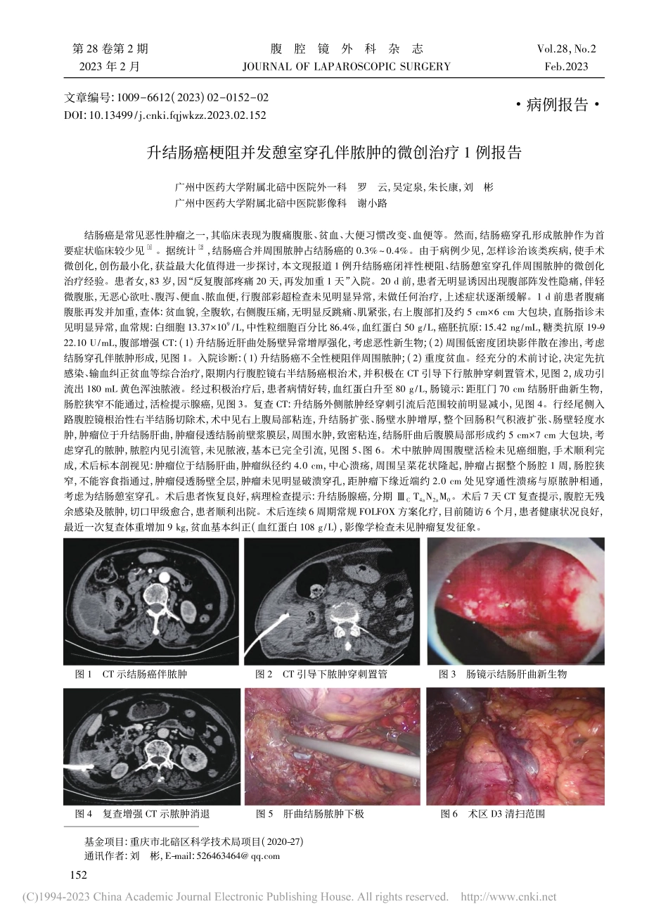 升结肠癌梗阻并发憩室穿孔伴脓肿的微创治疗1例报告_罗云.pdf_第1页