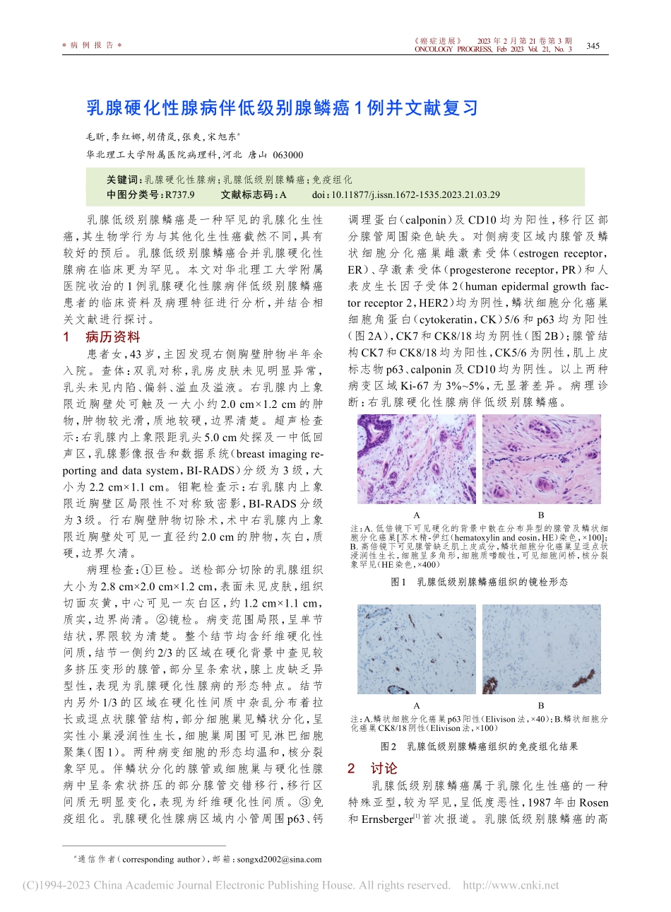 乳腺硬化性腺病伴低级别腺鳞癌1例并文献复习_毛昕.pdf_第1页