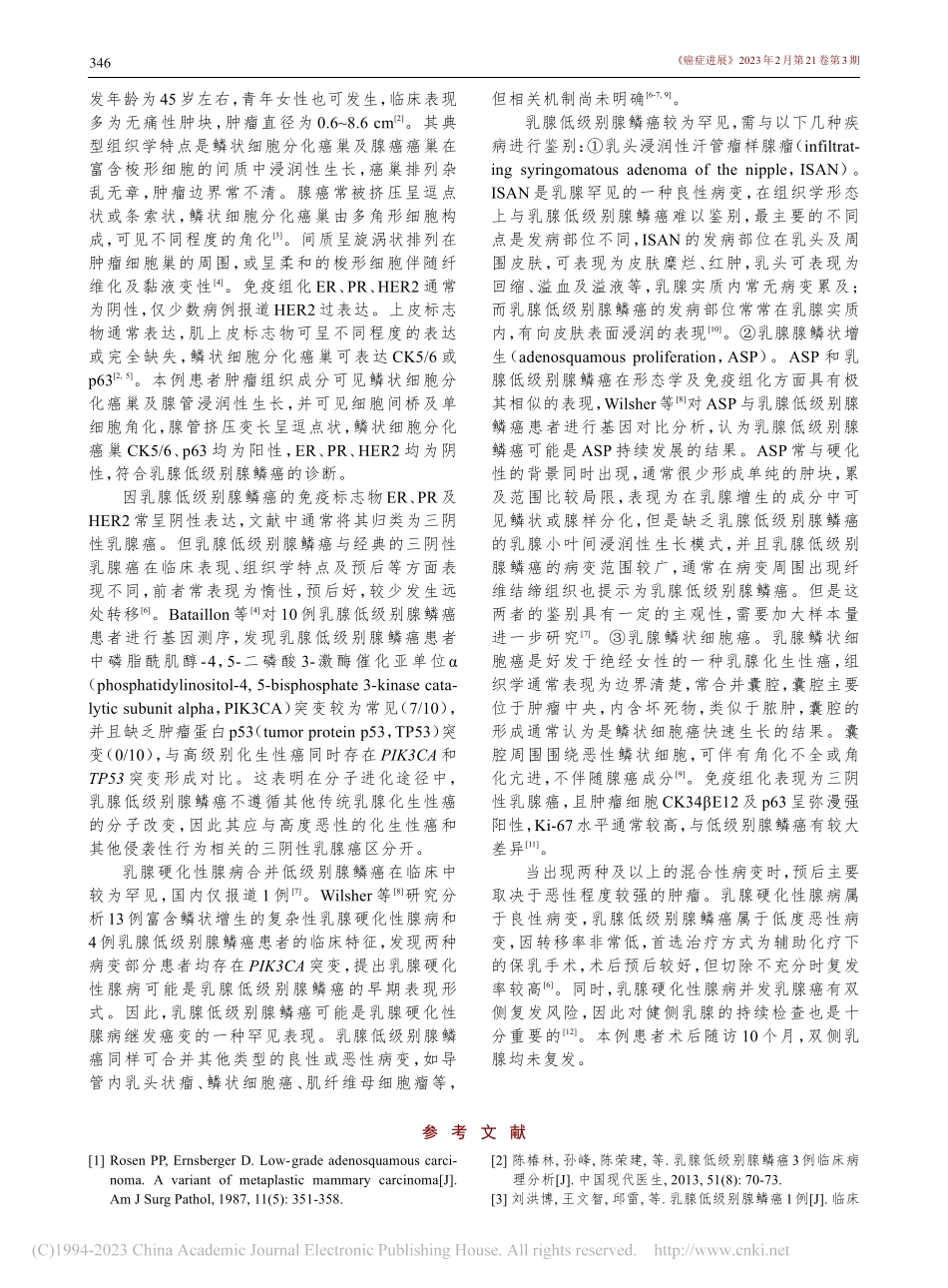 乳腺硬化性腺病伴低级别腺鳞癌1例并文献复习_毛昕.pdf_第2页