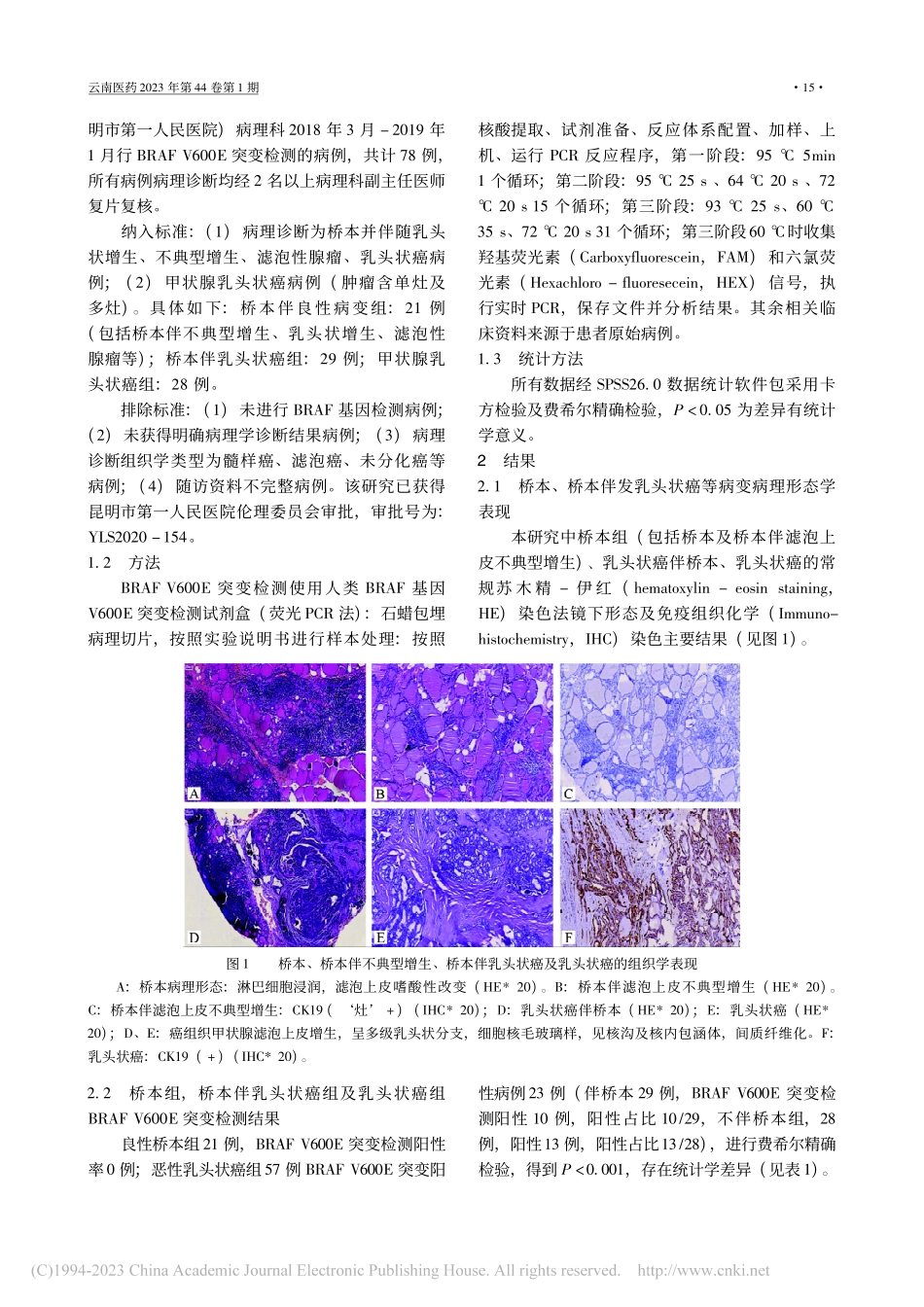 桥本氏甲状腺炎伴发病变中B...V600E基因突变率的研究_邓菊庆.pdf_第2页