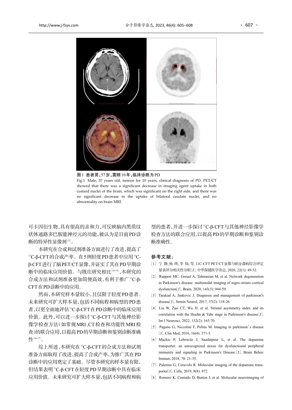 %5E%2811%29C-β-CFT：多巴胺转运蛋白显像剂的合成及其在帕金森病诊断中的应用.pdf_第3页