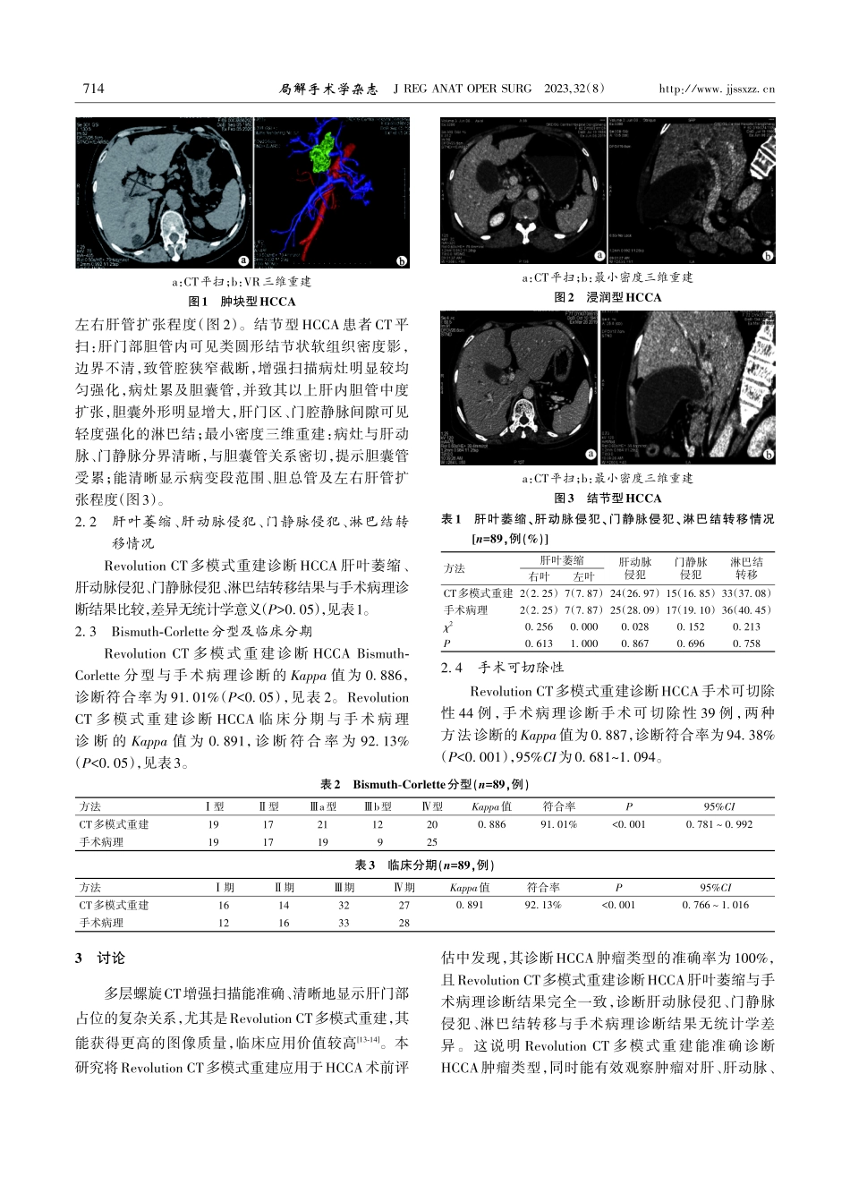 Revolution CT多模式重建对肝门部胆管癌术前分期及手术方式评估的研究.pdf_第3页
