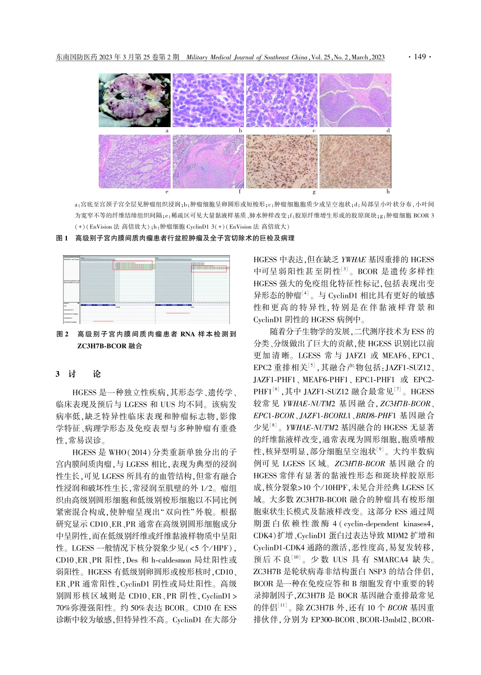 ZC3H7B-BCOR融合的高级别子宫内膜间质肉瘤的临床病理学分析.pdf_第3页