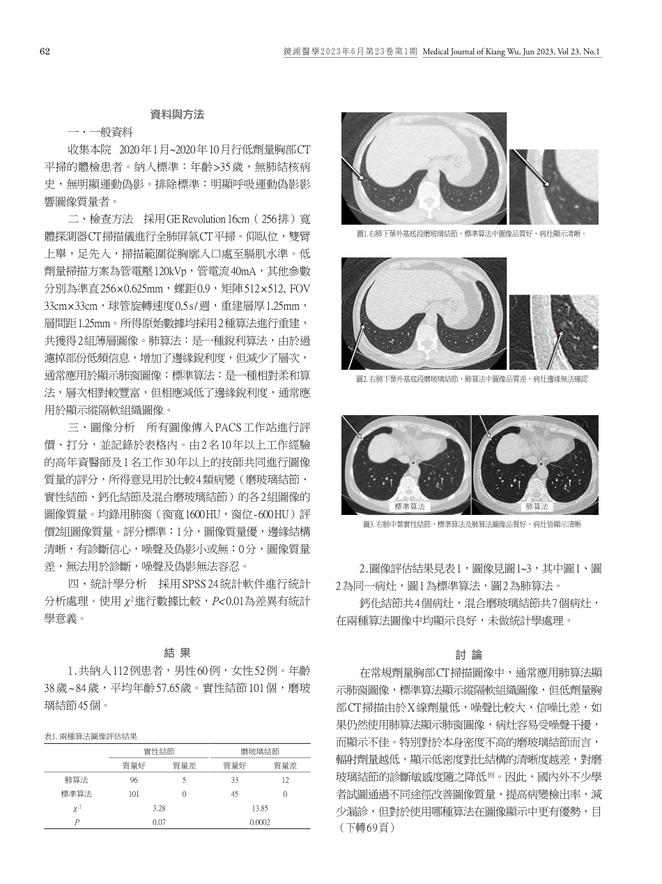 標準算法與肺算法在低劑量胸部CT圖像質量比較.pdf_第2页