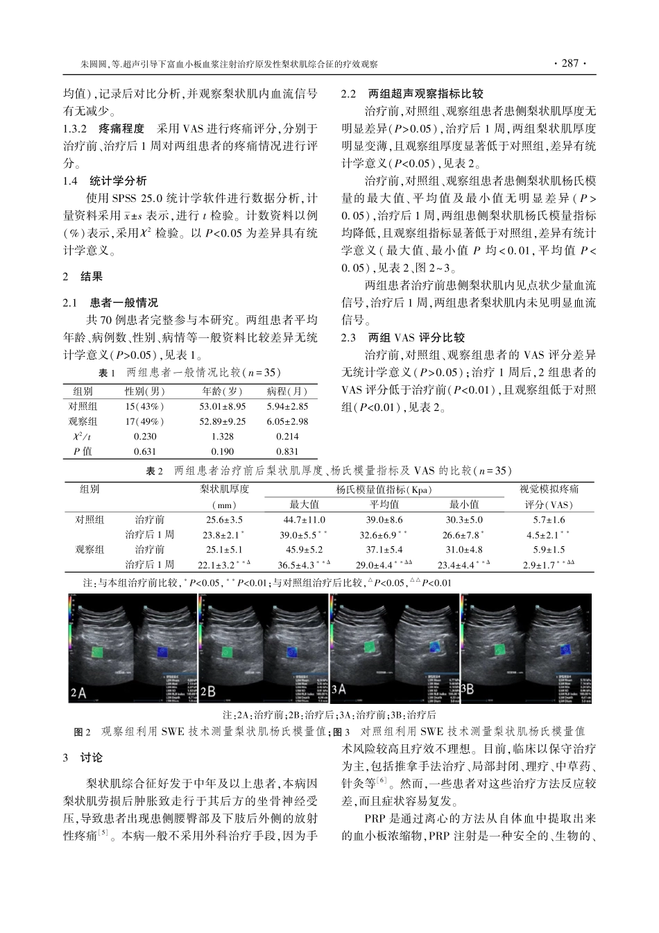 超声引导下富血小板血浆注射治疗原发性梨状肌综合征的疗效观察.pdf_第3页