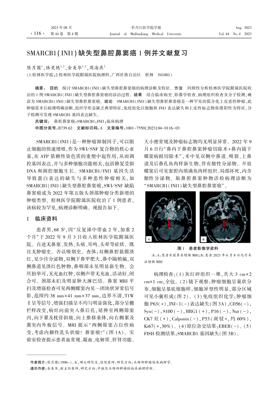 SMARCB1%28INI1%29缺失型鼻腔鼻窦癌1例并文献复习.pdf_第1页