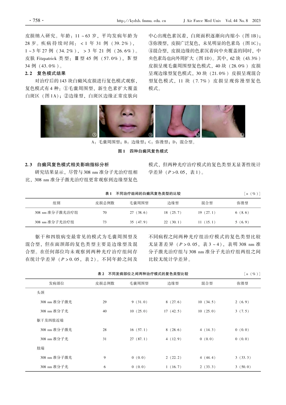 308 nm准分子激光及308 nm准分子光治疗白癜风皮损复色模式分析.pdf_第3页