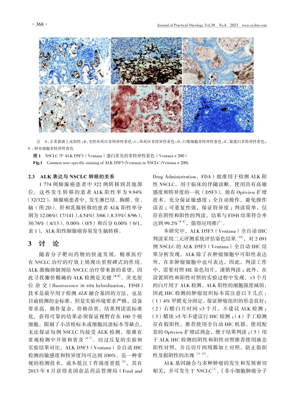 2091例非小细胞肺癌ALK D5F3表达及其与临床病理特征的关系.pdf_第3页