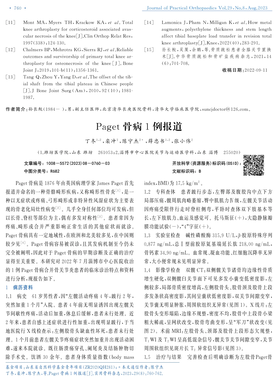 Paget骨病1例报道.pdf_第1页
