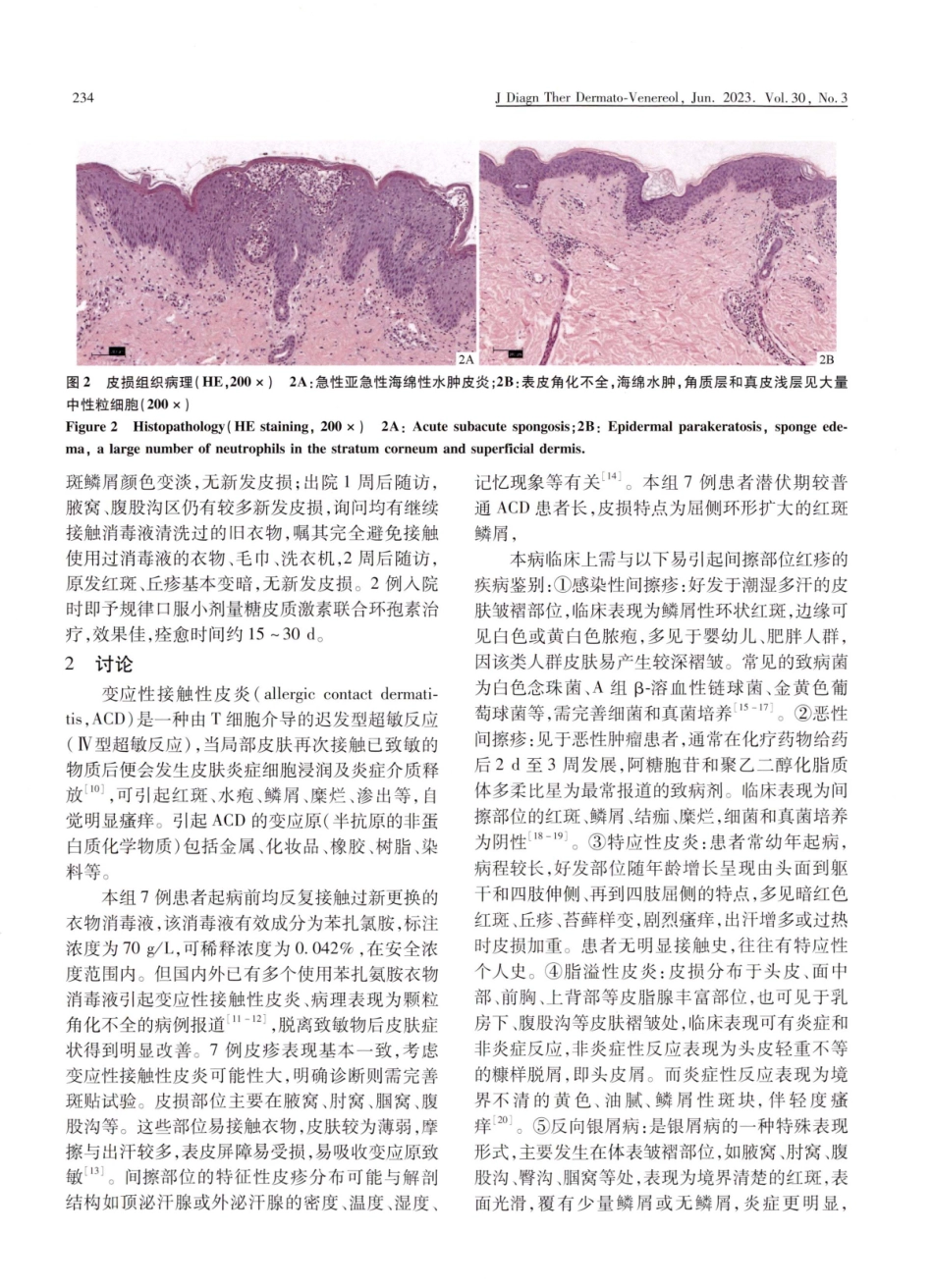 苯扎氯铵消毒液引起的相关皮炎的临床及病理特征：附7例报告.pdf_第3页
