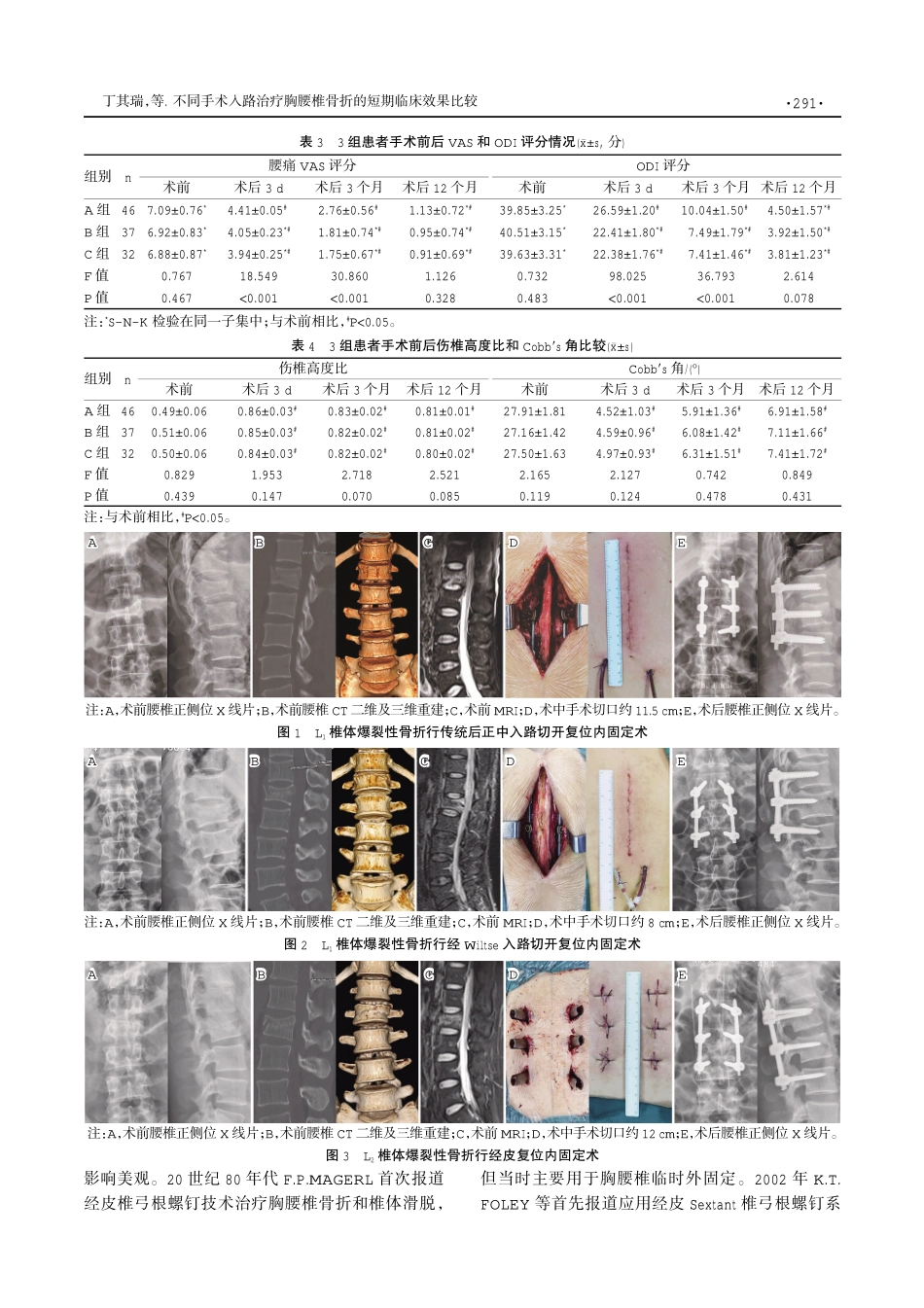 不同手术入路治疗胸腰椎骨折的短期临床效果比较.pdf_第3页