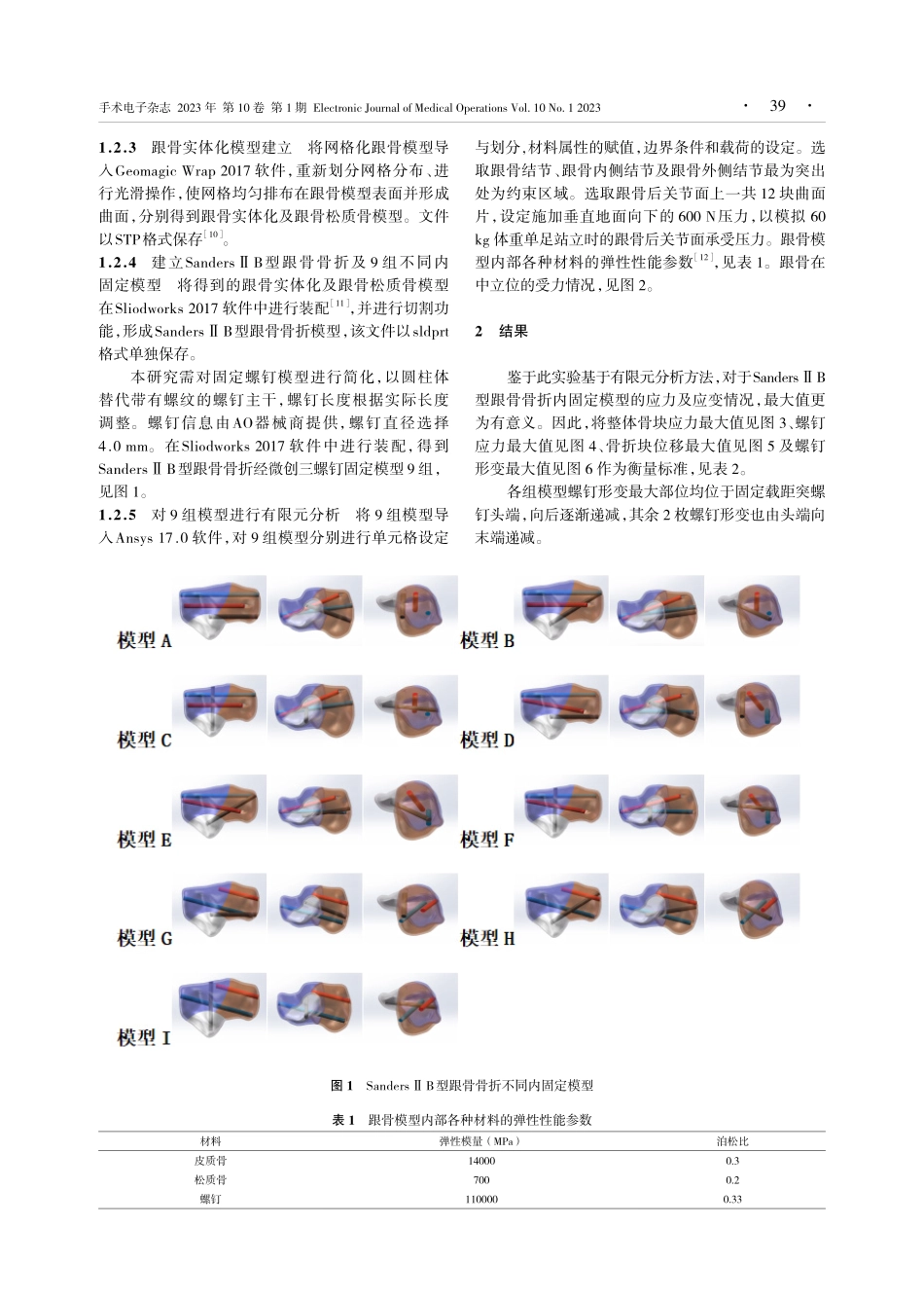 SandersⅡB型跟骨骨折三螺钉固定力学稳定性有限元分析.pdf_第3页