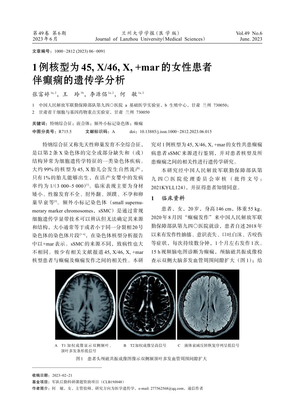 1例核型为45%2CX_46%2CX%2C mar的女性患者伴癫痫的遗传学分析.pdf_第1页