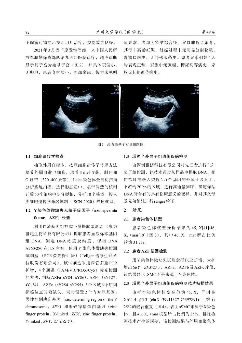 1例核型为45%2CX_46%2CX%2C mar的女性患者伴癫痫的遗传学分析.pdf_第2页