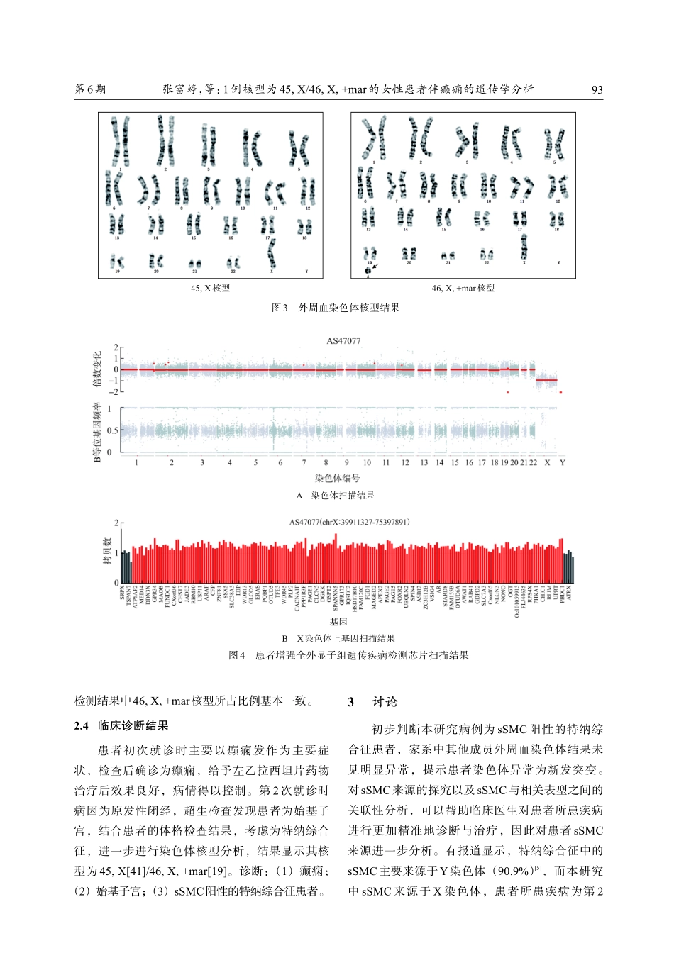 1例核型为45%2CX_46%2CX%2C mar的女性患者伴癫痫的遗传学分析.pdf_第3页
