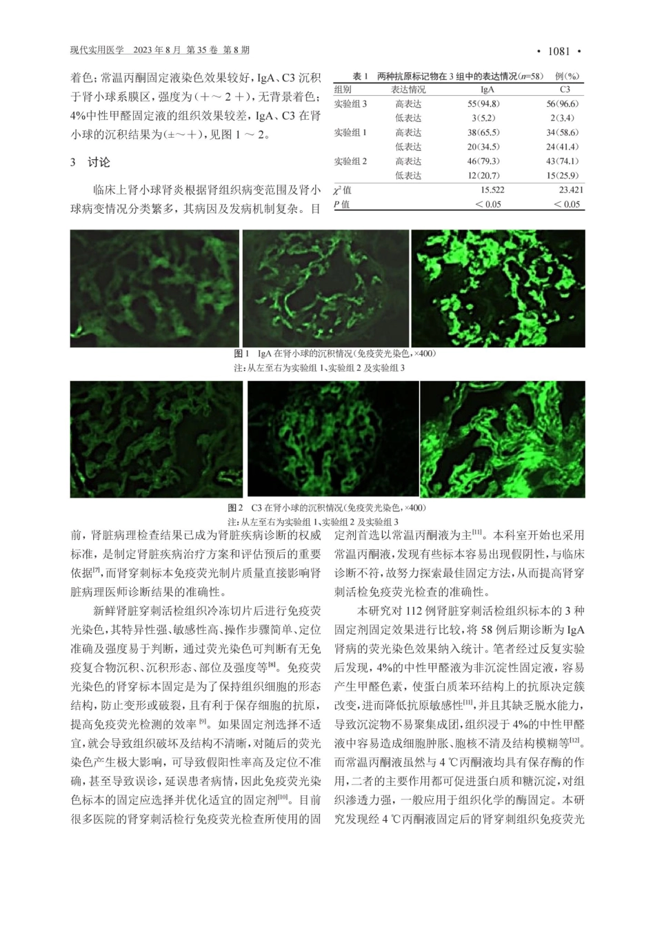 4℃丙酮液固定剂对肾穿刺活检组织免疫荧光染色的效果观察.pdf_第2页