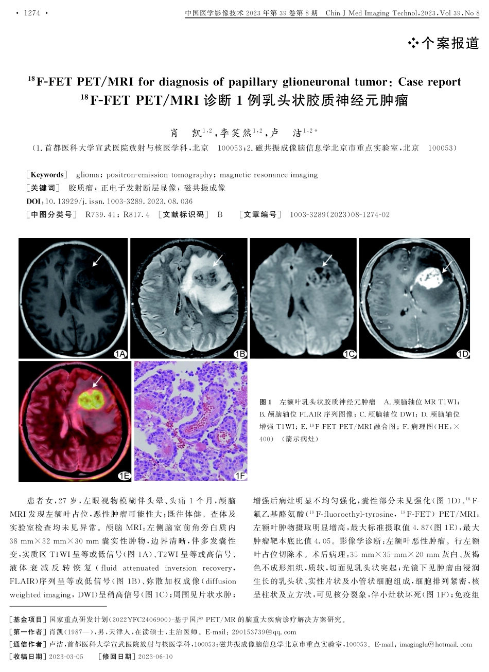 %5E%2818%29F-FET PET_MRI诊断1例乳头状胶质神经元肿瘤.pdf_第1页