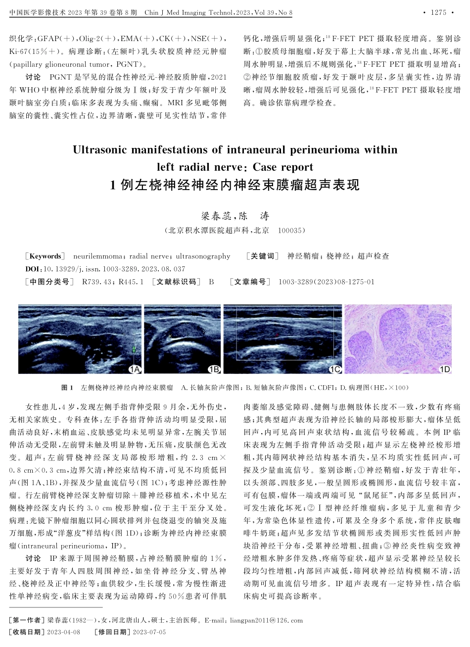 %5E%2818%29F-FET PET_MRI诊断1例乳头状胶质神经元肿瘤.pdf_第2页