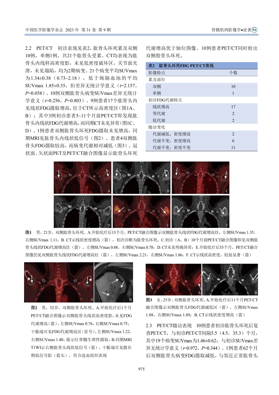 %5E%2818%29F-FDG PET_CT评价肱骨头坏死.pdf_第3页