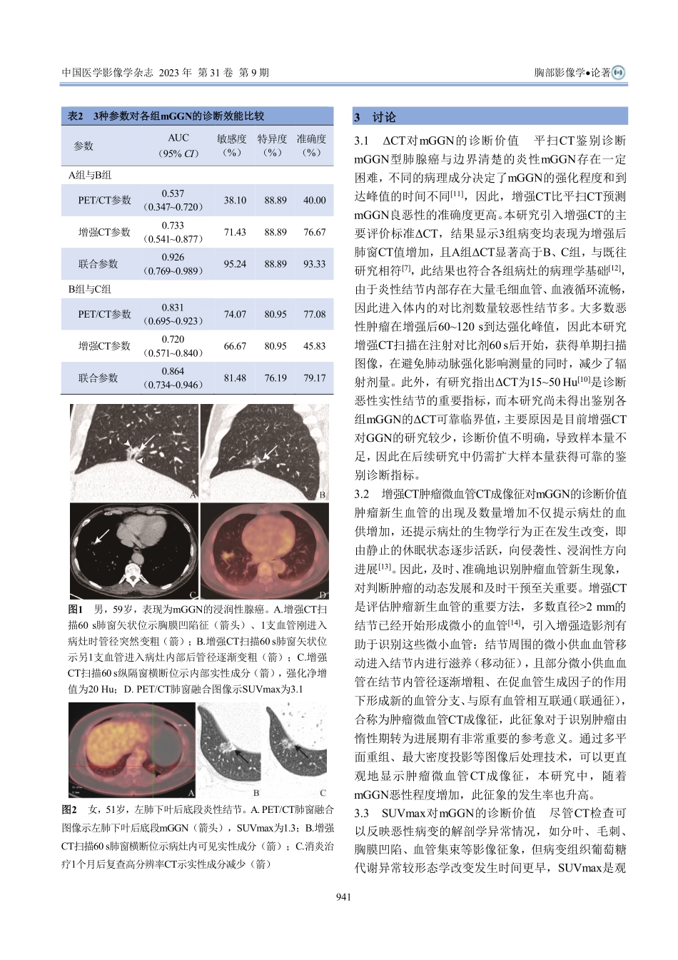%5E%2818%29F-FDG PET_CT联合增强CT对肺部混合磨玻璃结节的诊断价值.pdf_第3页