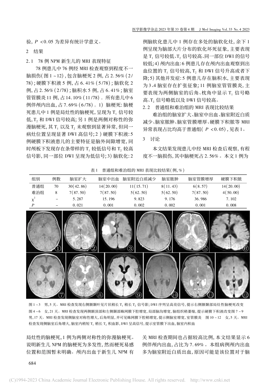 新生儿化脓性脑膜炎的头颅MRI特点及对预后的评估价值_陈亚敏.pdf_第2页