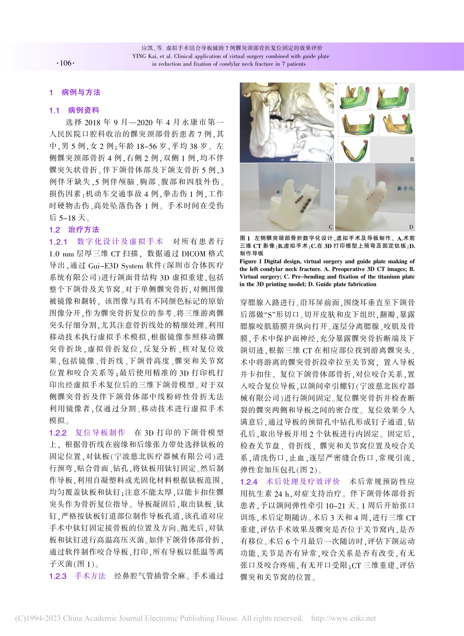 虚拟手术结合导板辅助7例髁...颈部骨折复位固定的效果评价_应凯.pdf_第2页