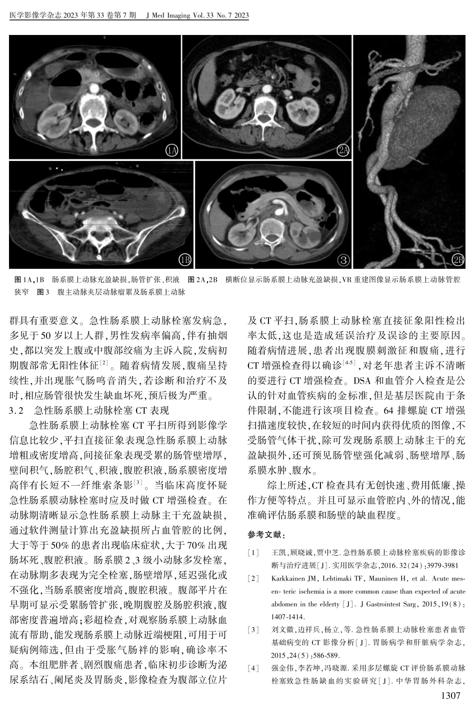 64排螺旋CT在急性肠系膜上动脉栓塞的诊断价值.pdf_第2页