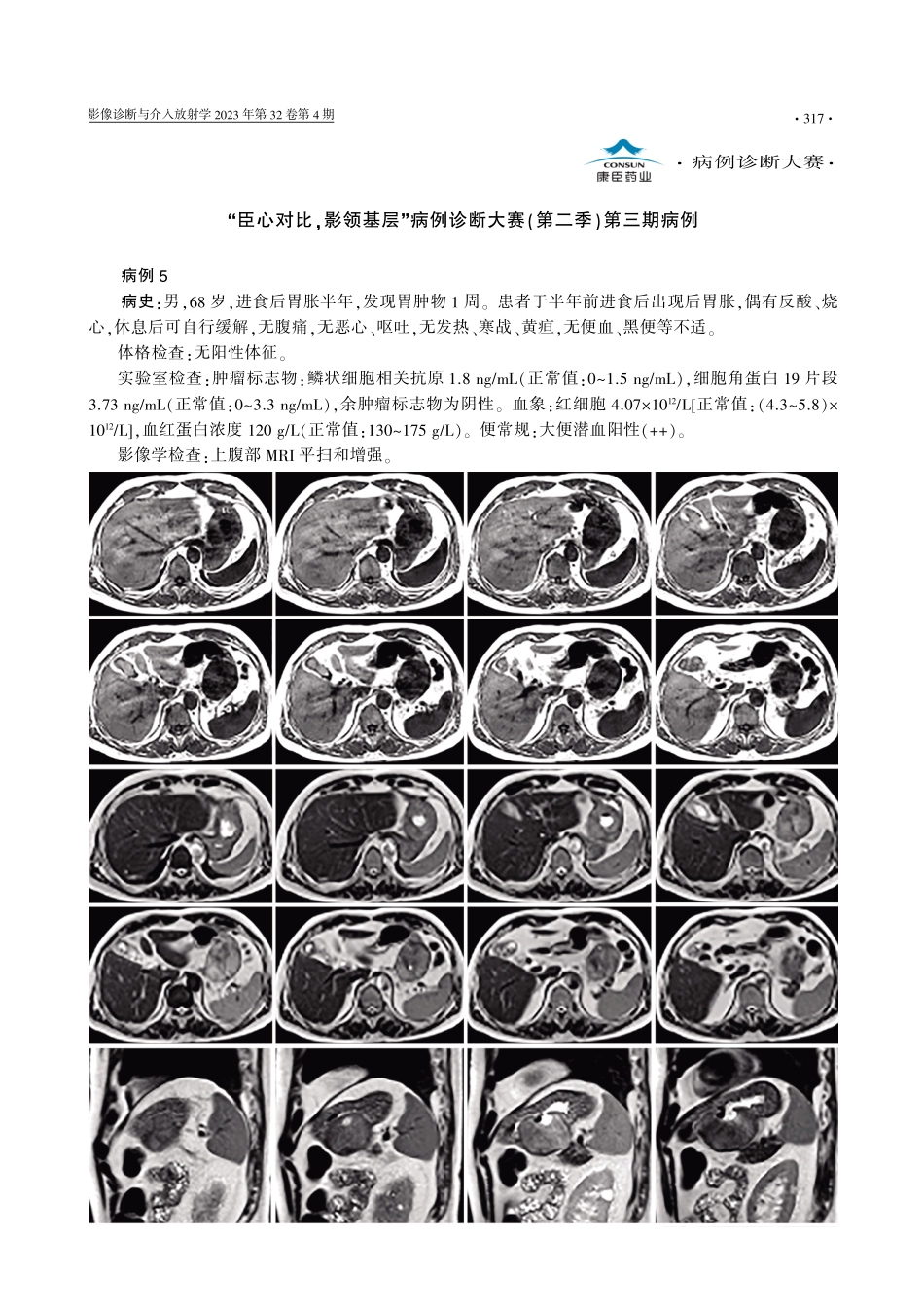 “臣心对比%2C影领基层”病例诊断大赛%28第二季%29第三期病例.pdf_第1页