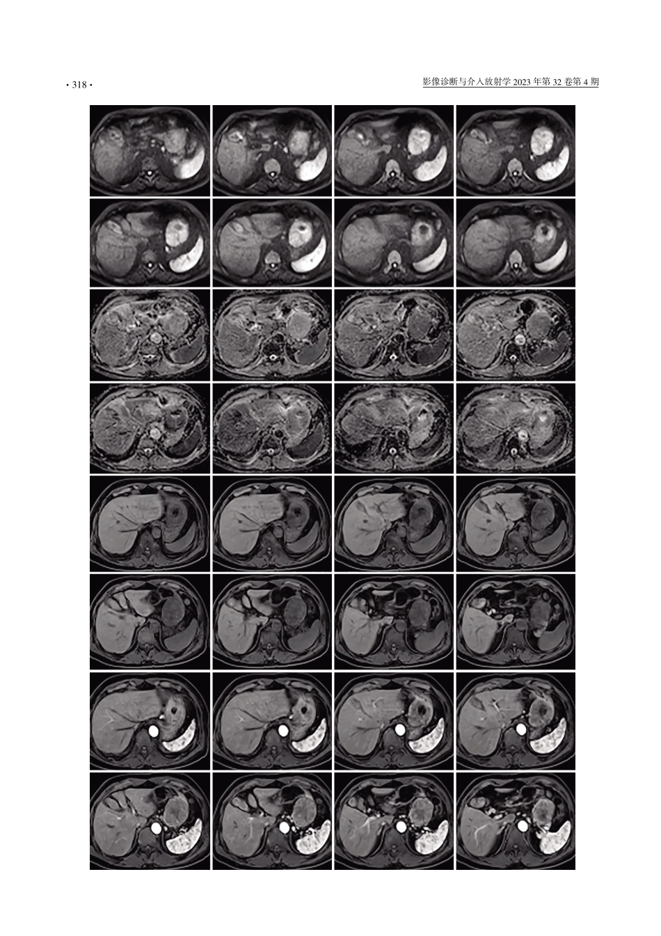 “臣心对比%2C影领基层”病例诊断大赛%28第二季%29第三期病例.pdf_第2页