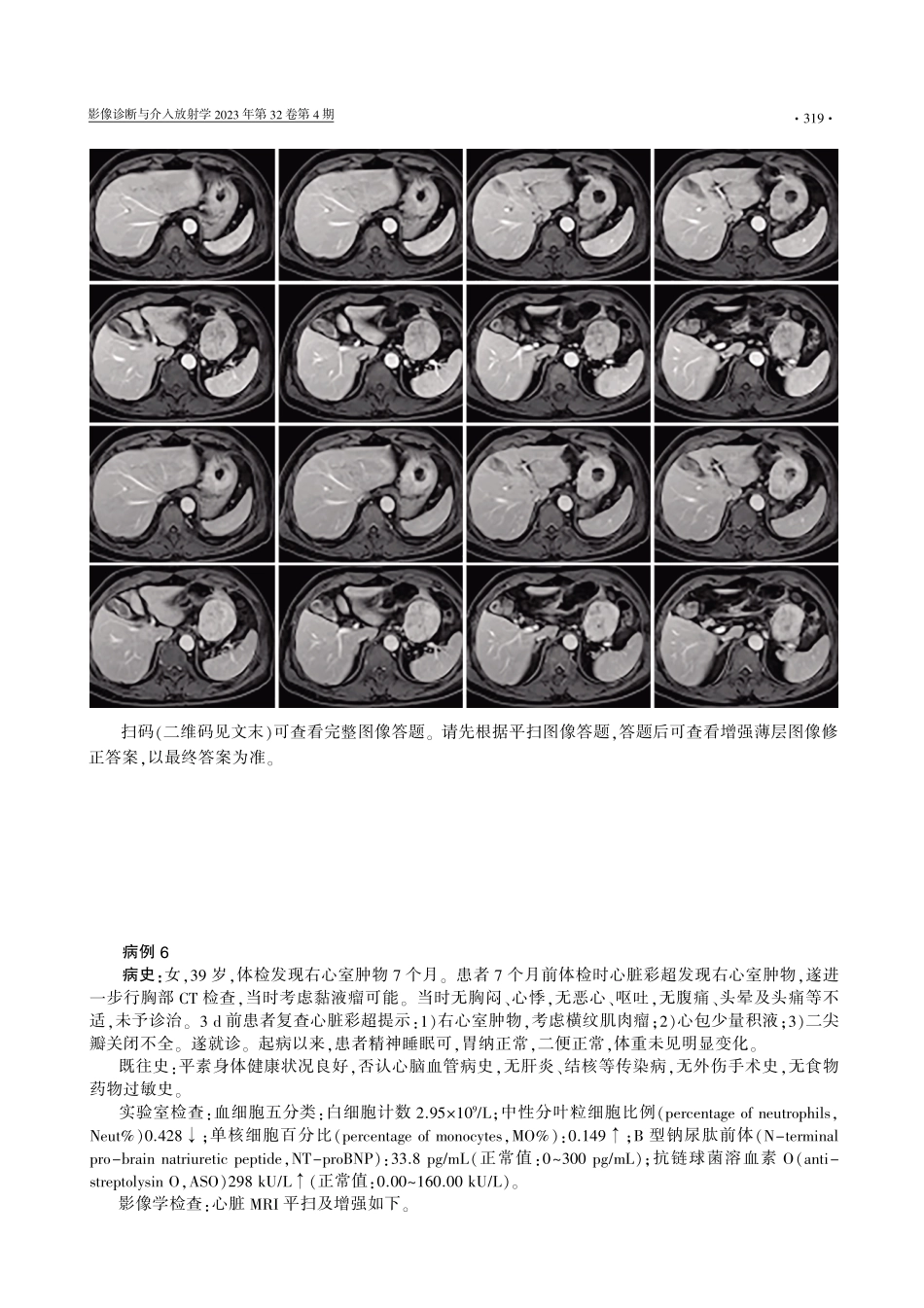 “臣心对比%2C影领基层”病例诊断大赛%28第二季%29第三期病例.pdf_第3页