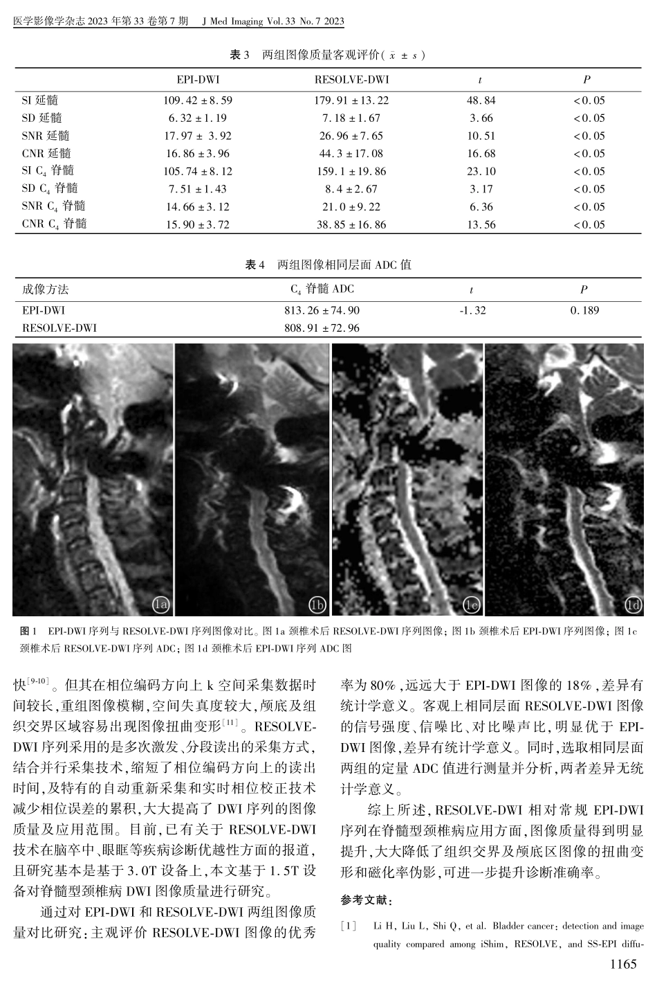 RESOLVE-DWI技术在脊髓型颈椎病成像中的应用研究.pdf_第3页