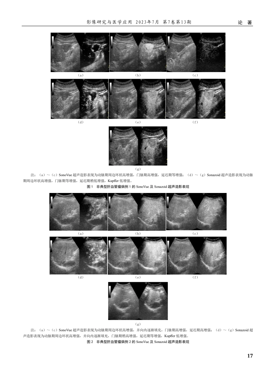 Sonazoid与SonoVue超声造影在肝血管瘤诊断中的应用价值研究.pdf_第3页