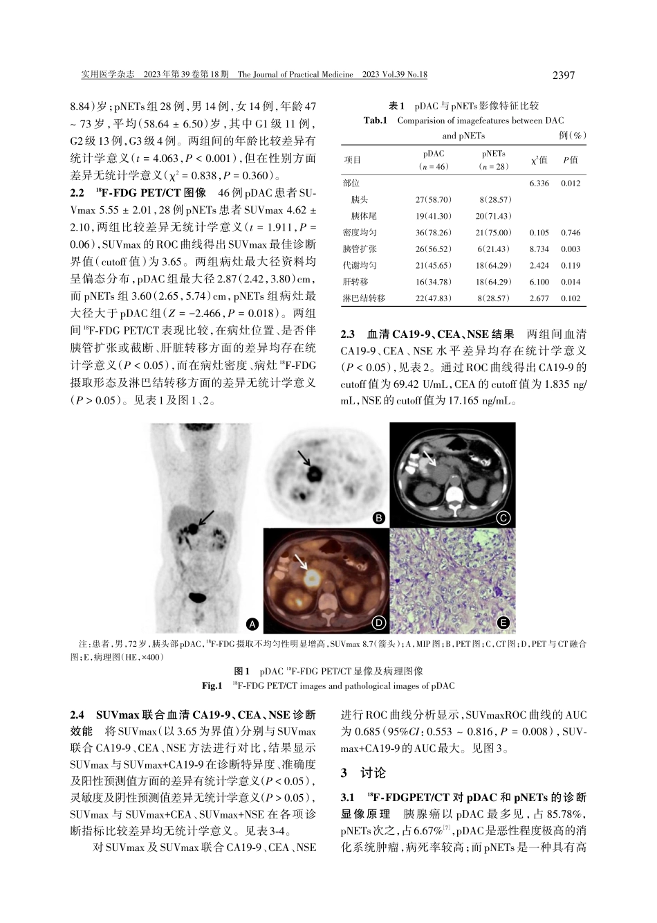 %5E%2818%29F-FDG PET_CT联合血清CA19-9、CEA、NSE鉴别胰腺导管腺癌与胰腺神经内分泌肿瘤.pdf_第3页
