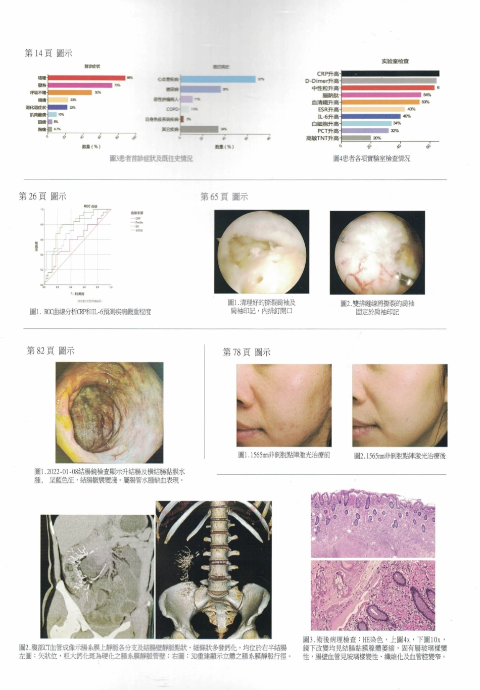 遺傳性癲癇伴熱性驚厥附加症1例.pdf_第3页