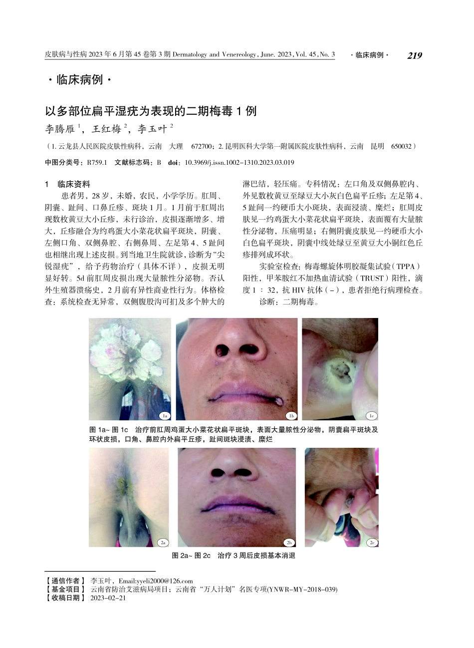 以多部位扁平湿疣为表现的二期梅毒1例.pdf_第1页