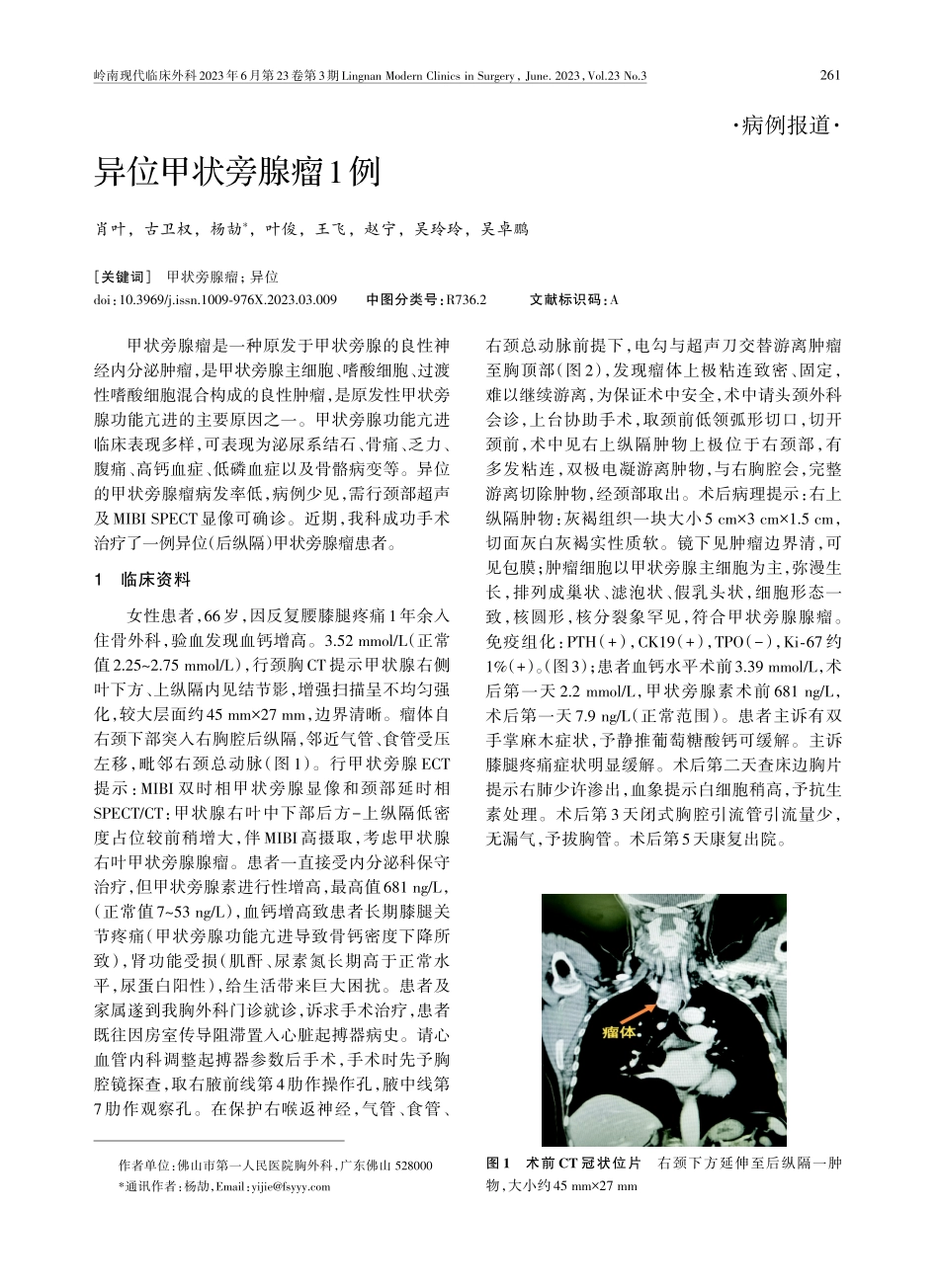 异位甲状旁腺瘤1例.pdf_第1页
