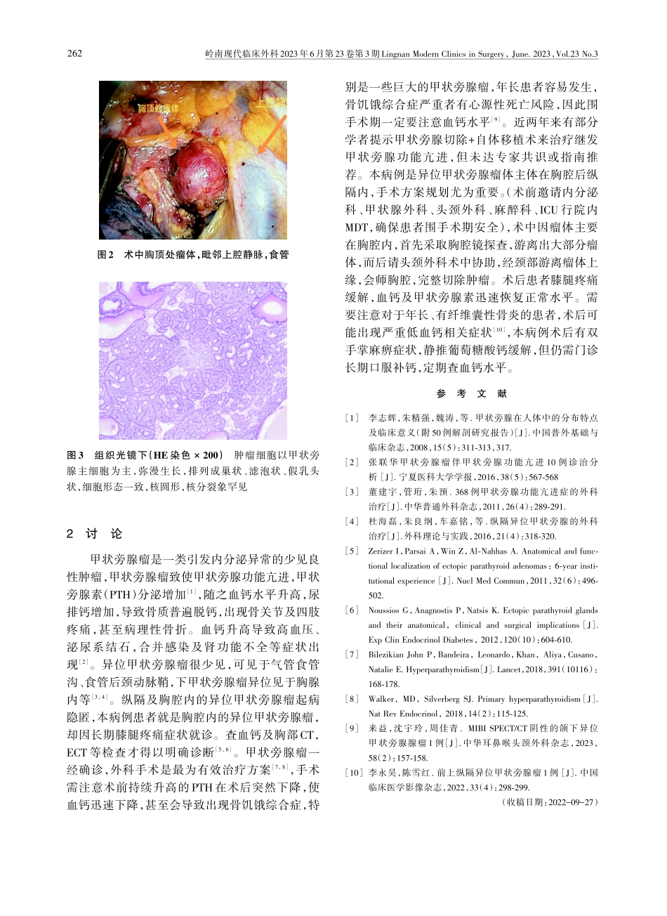 异位甲状旁腺瘤1例.pdf_第2页