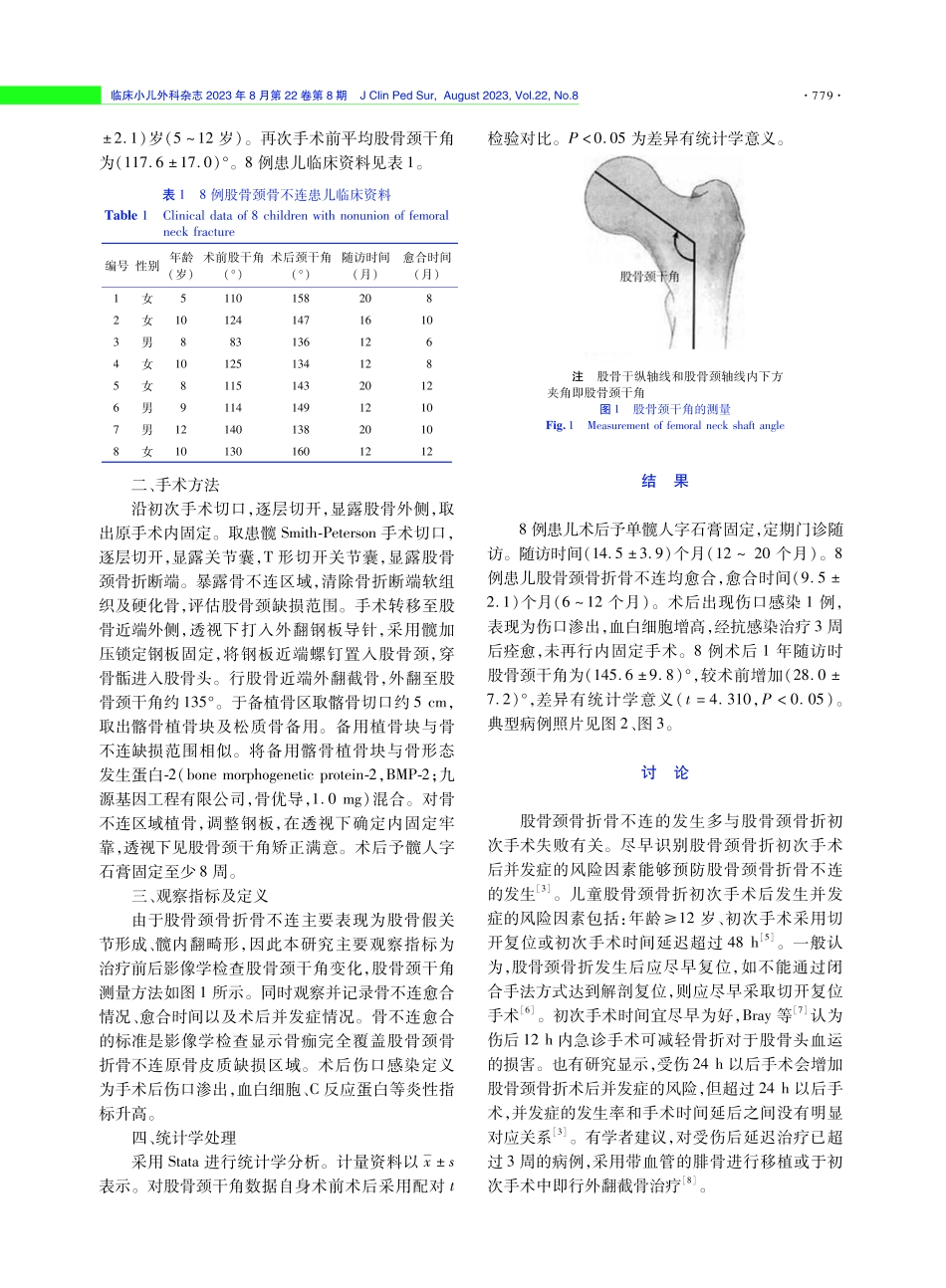股骨近端外翻截骨植骨术治疗儿童股骨颈骨折骨不连的疗效探讨.pdf_第2页