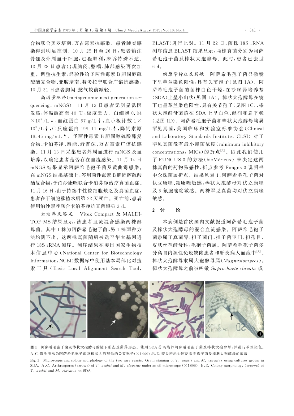 骨髓移植患者血流混合感染阿萨希毛孢子菌及棒状大孢酵母1例.pdf_第2页