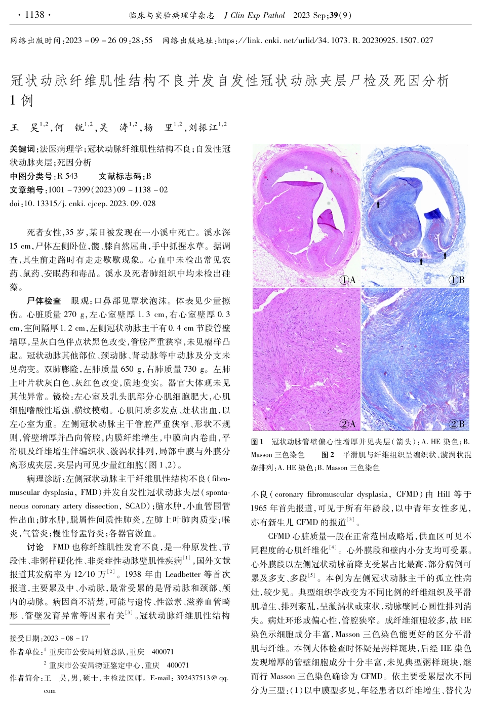 冠状动脉纤维肌性结构不良并发自发性冠状动脉夹层尸检及死因分析1例.pdf_第1页