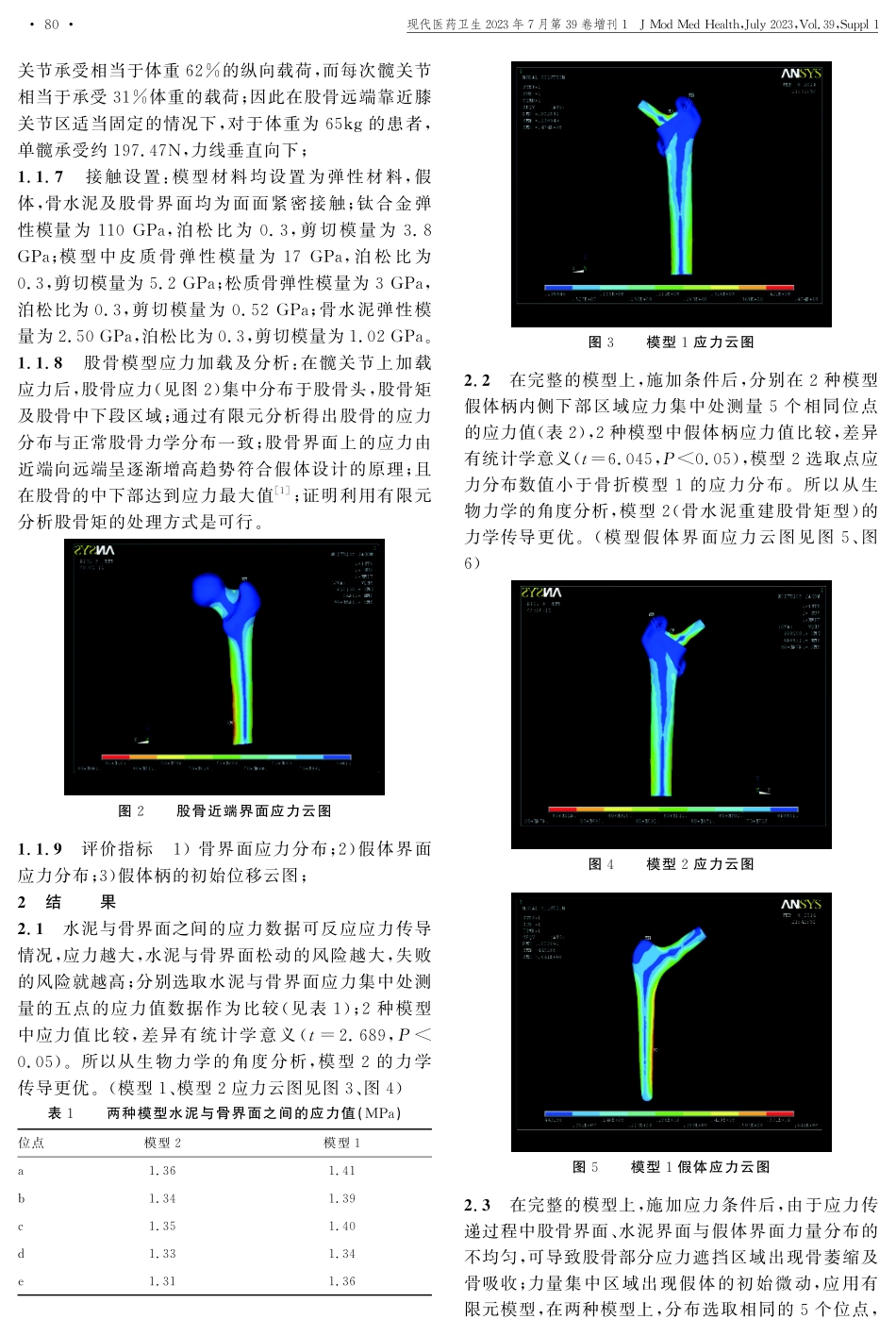 股骨粗隆间骨折人工股骨头置换不同股骨矩重建方式三维有限元分析.pdf_第2页