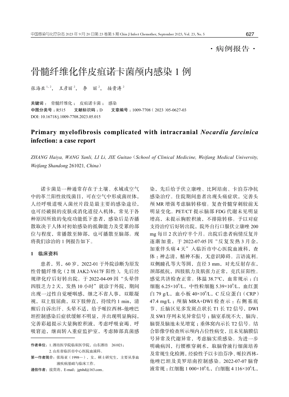 骨髓纤维化伴皮疽诺卡菌颅内感染1例.pdf_第1页