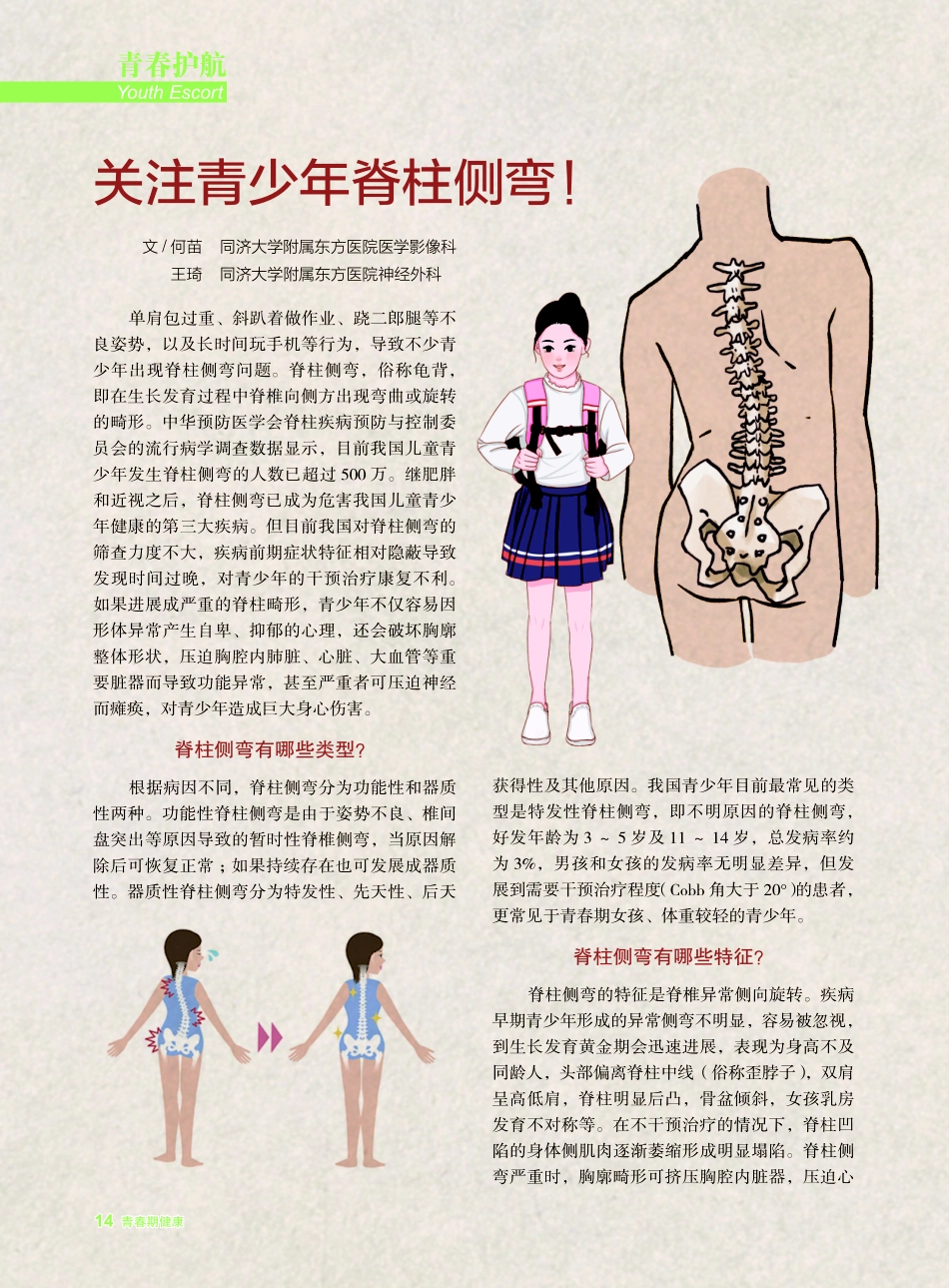 关注青少年脊柱侧弯%21.pdf_第1页