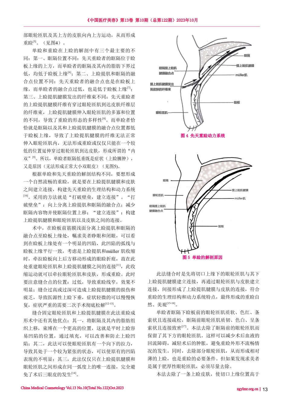 构建重睑生理结构和动力系统的重睑成形术.pdf_第3页