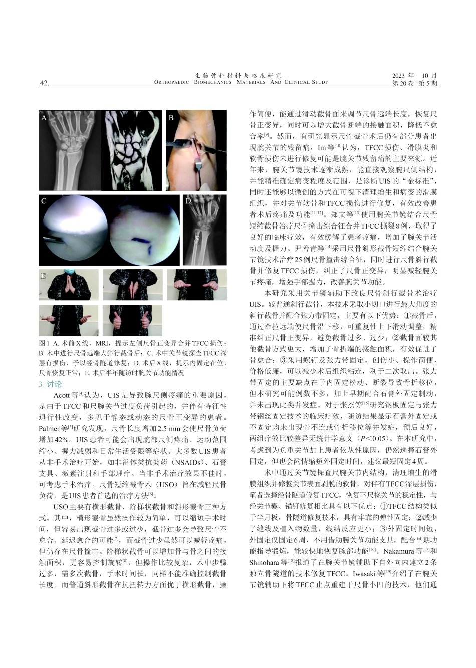 关节镜辅助下尺骨远端大斜形截骨张力带固定治疗尺骨撞击综合征的近期临床疗效观察.pdf_第3页